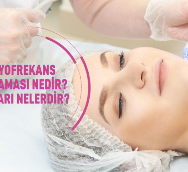 Radyofrekans Uygulaması Nedir, Faydaları Nelerdir