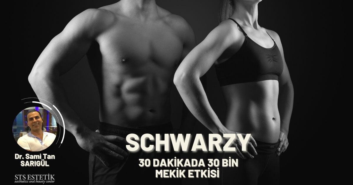 Schwarzy